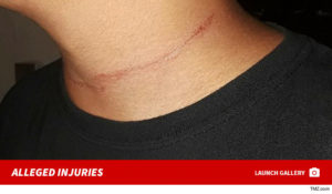 0729-alleged-injuries-sub-gallery-4